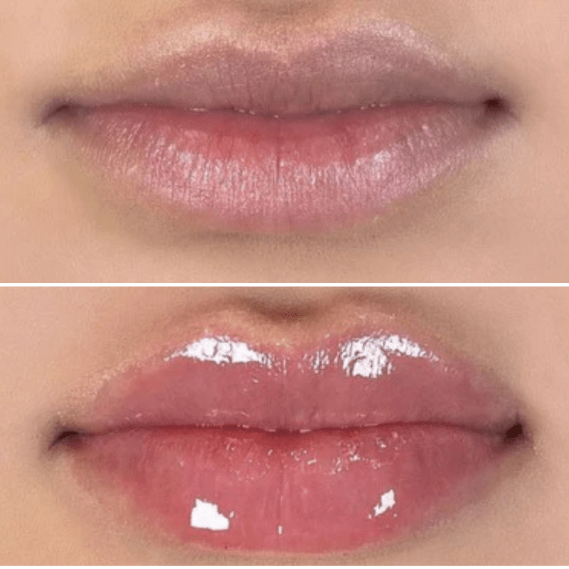 Perfect Lip Plumper™ - Glowskin Lab.
