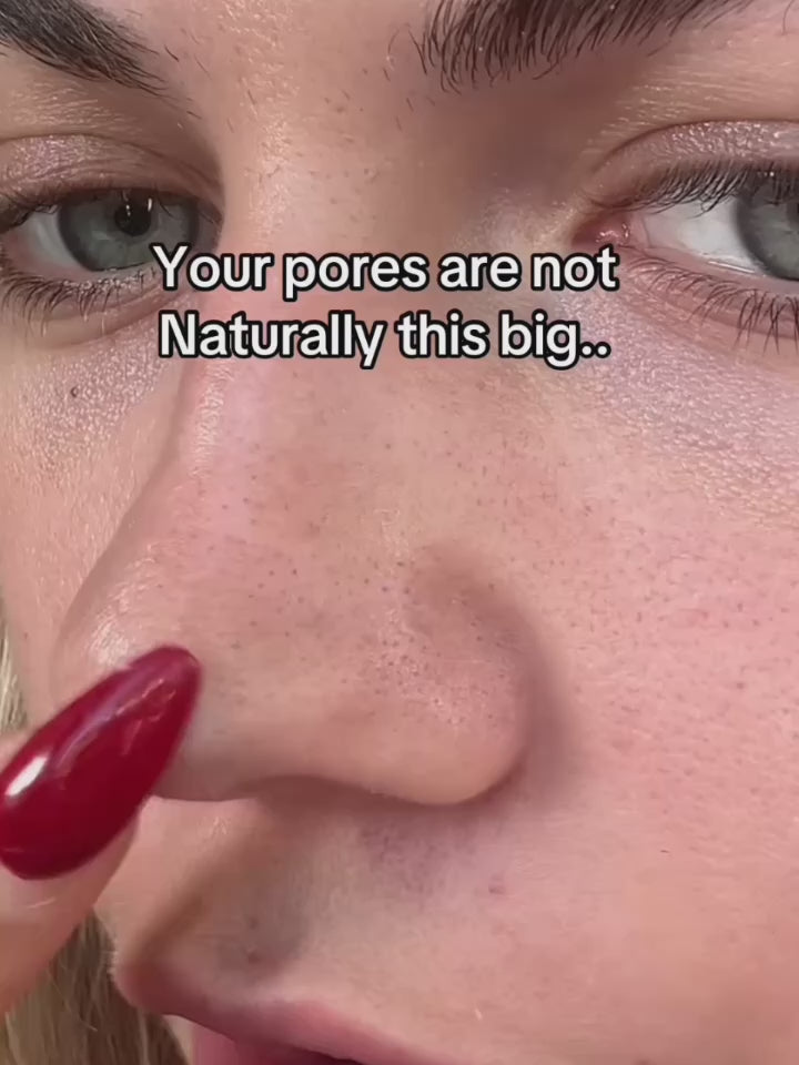 Vidéo